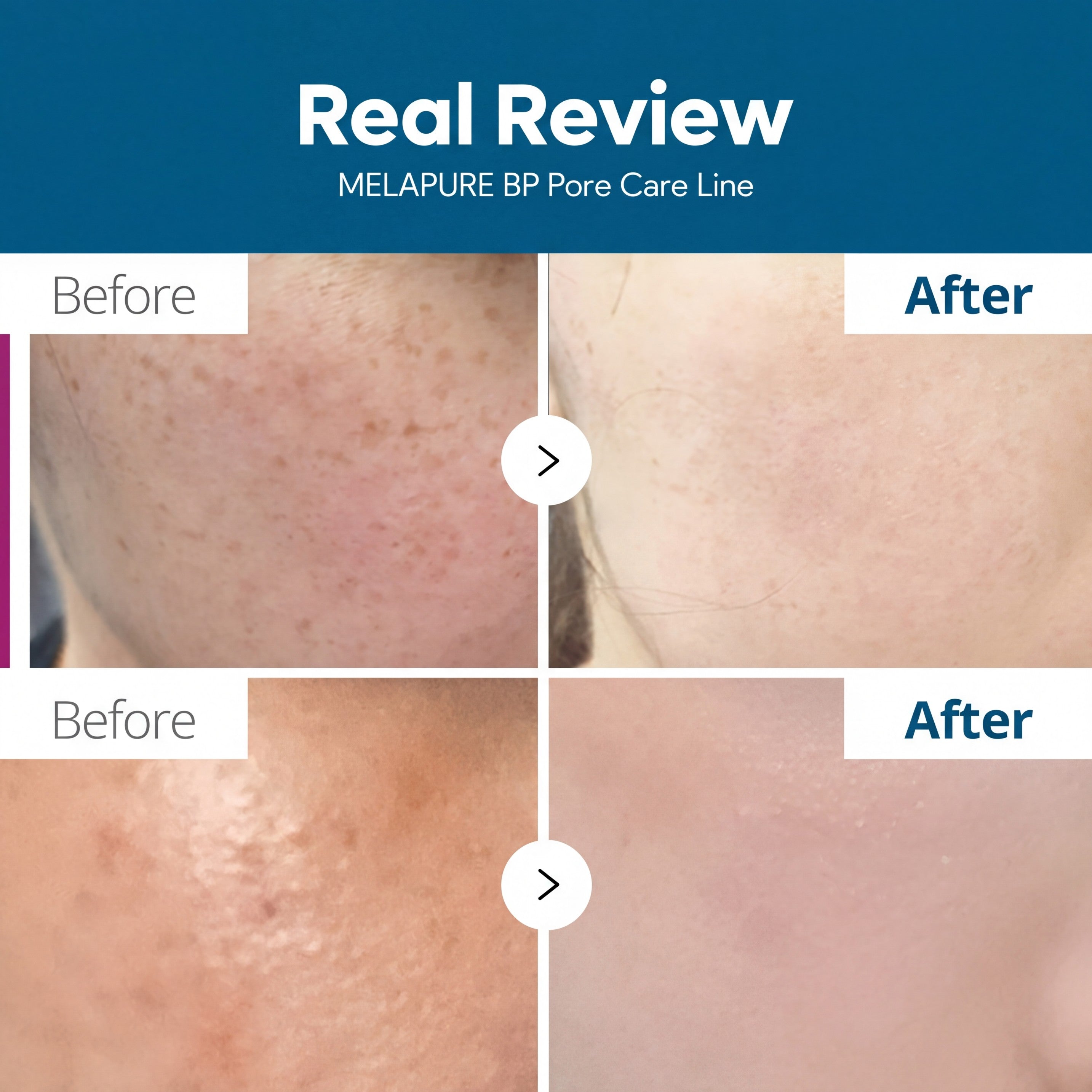 TX Freckle Care Line