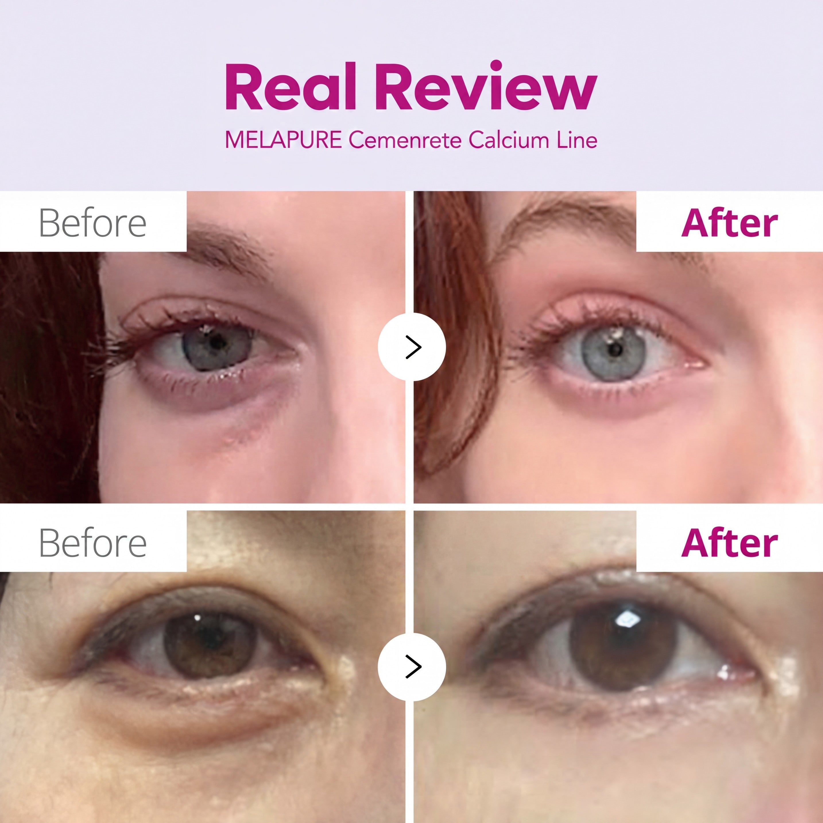 Cemenrete Collagen Calcium Eye Care Line