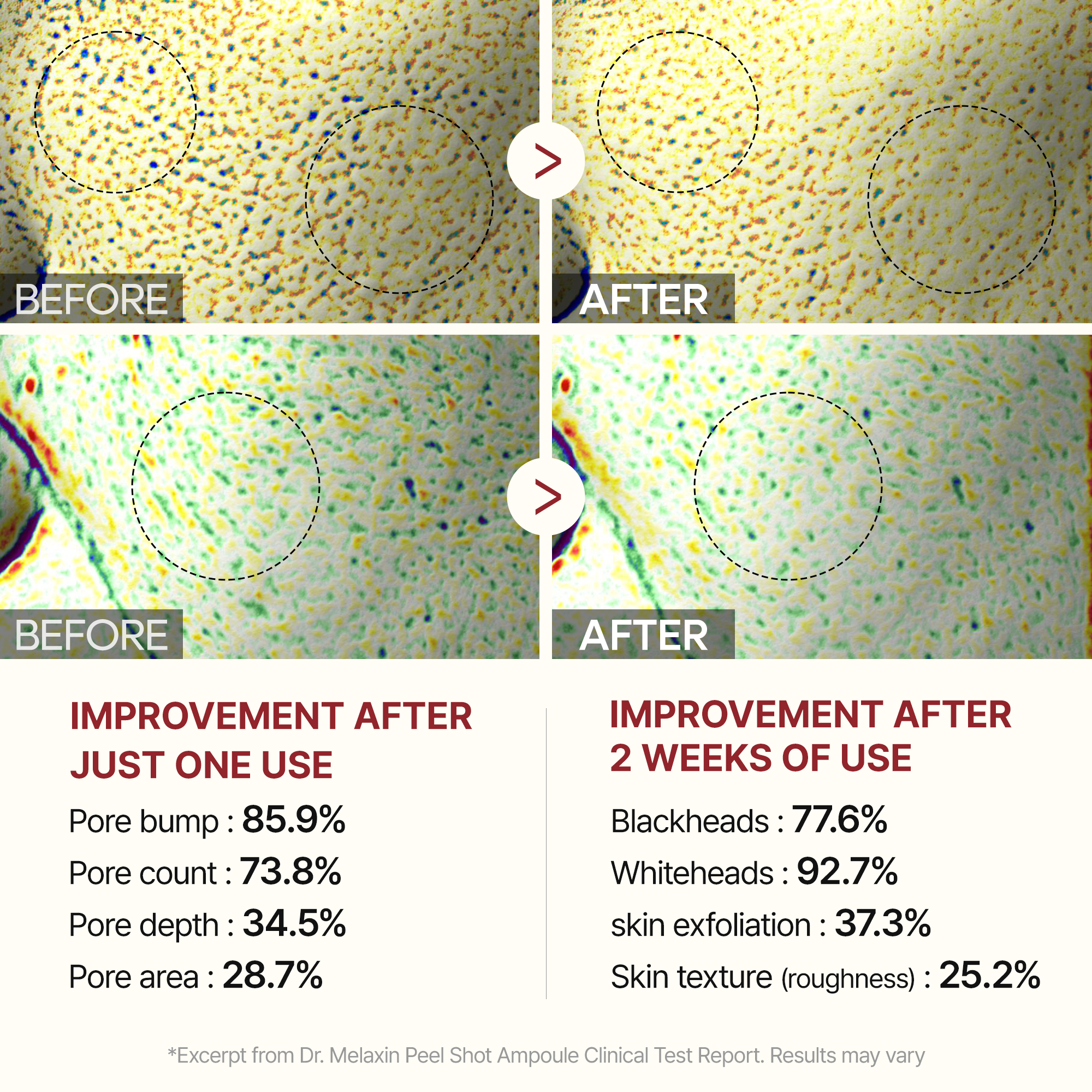 PEEL SHOT CARE BUNDLE SET