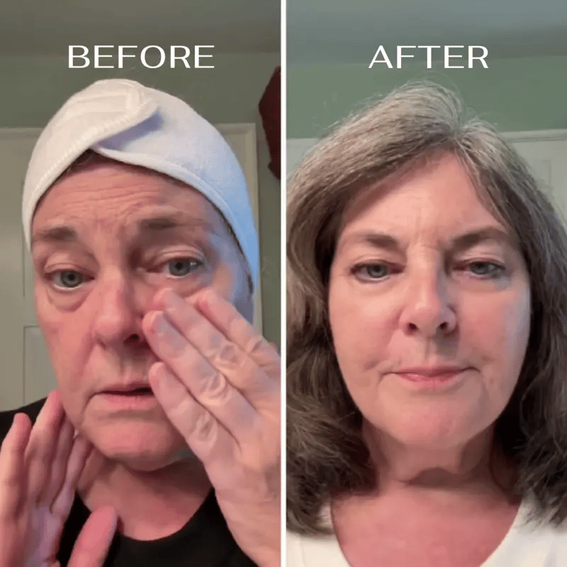 Real Results
your eyes will love