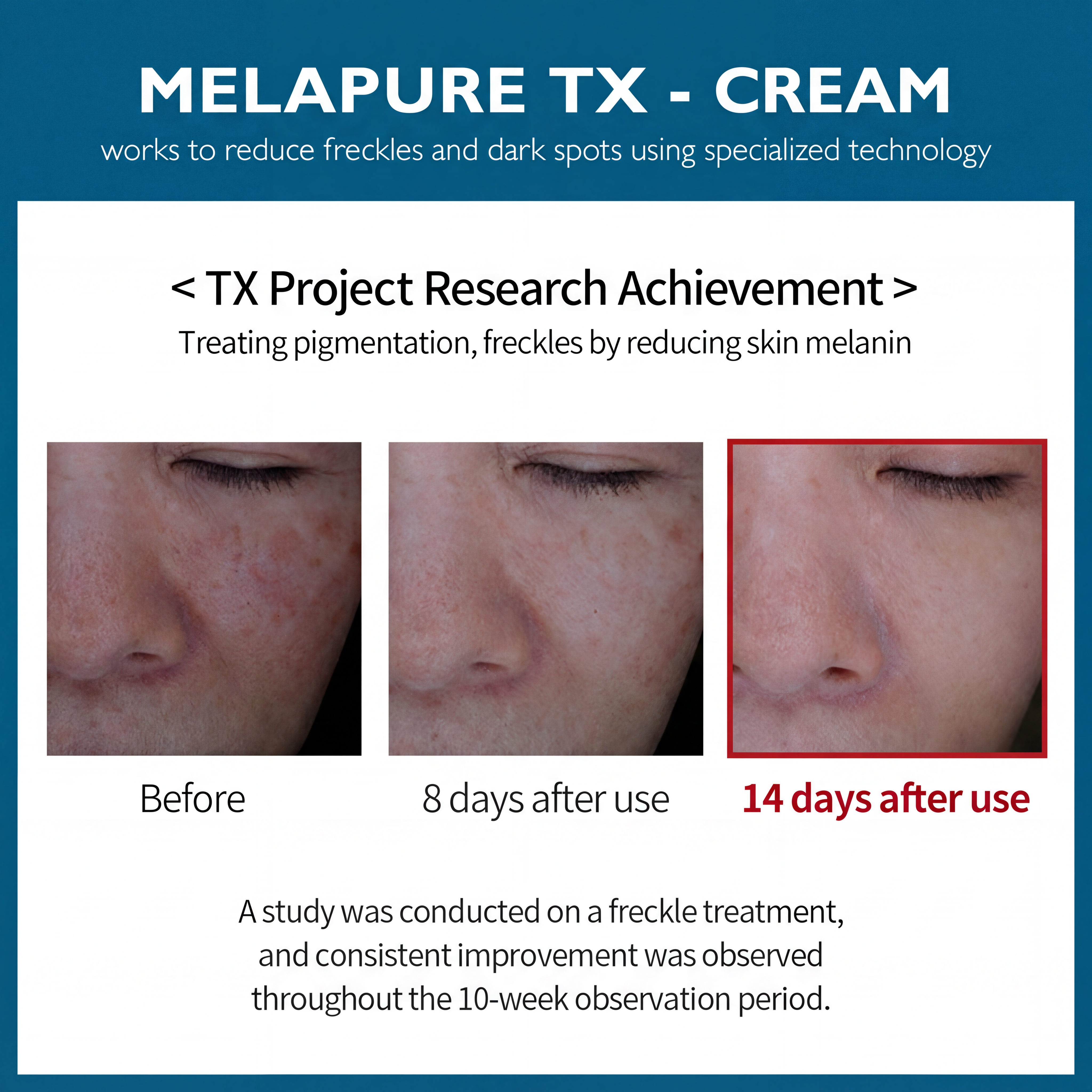 TX Freckle Care Line