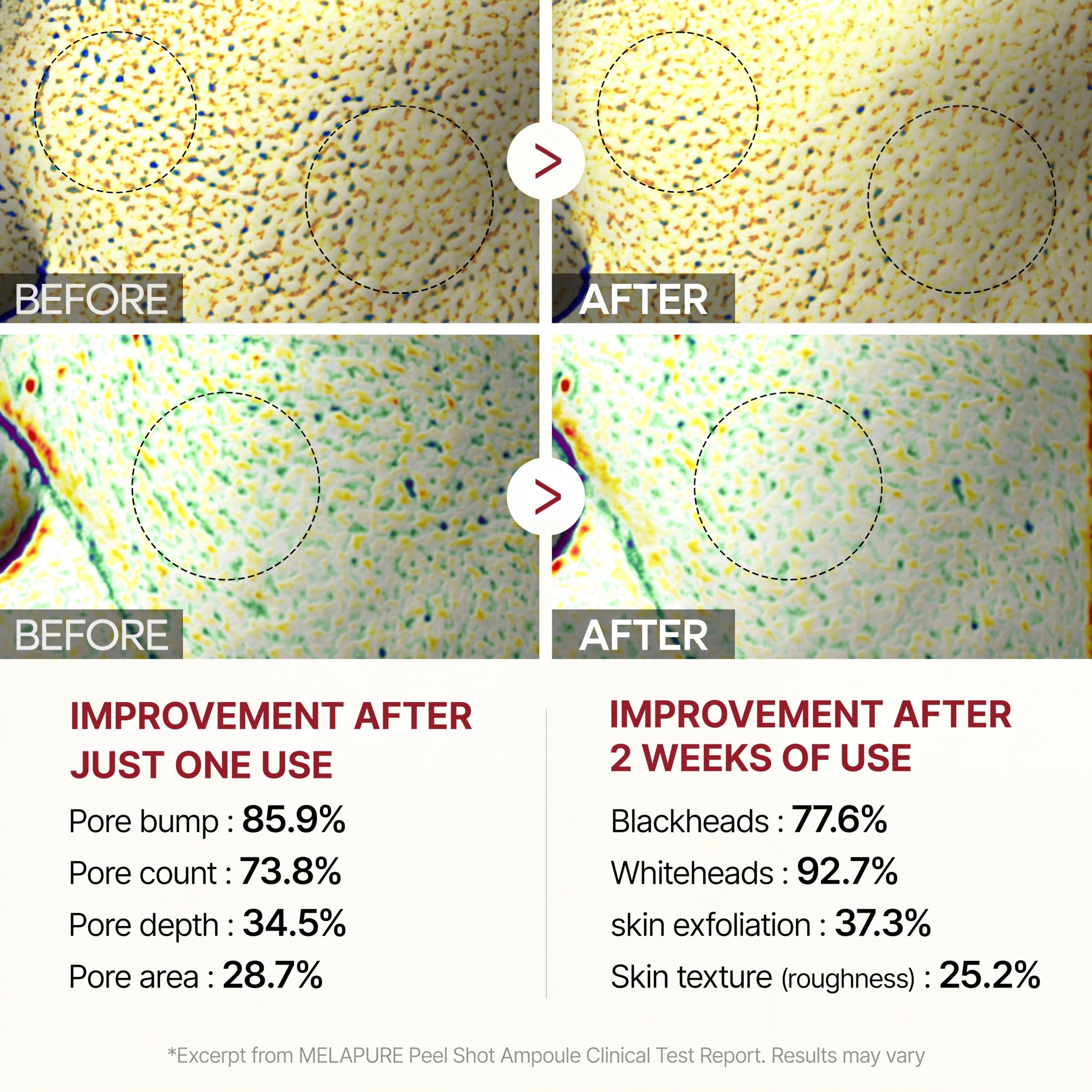 Peel Shot Glow Black Rice Ampoule