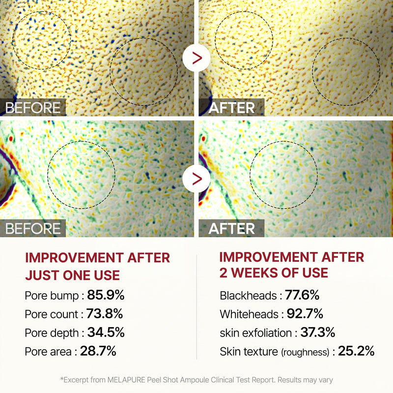 Peel Shot Glow Black Rice Ampoule