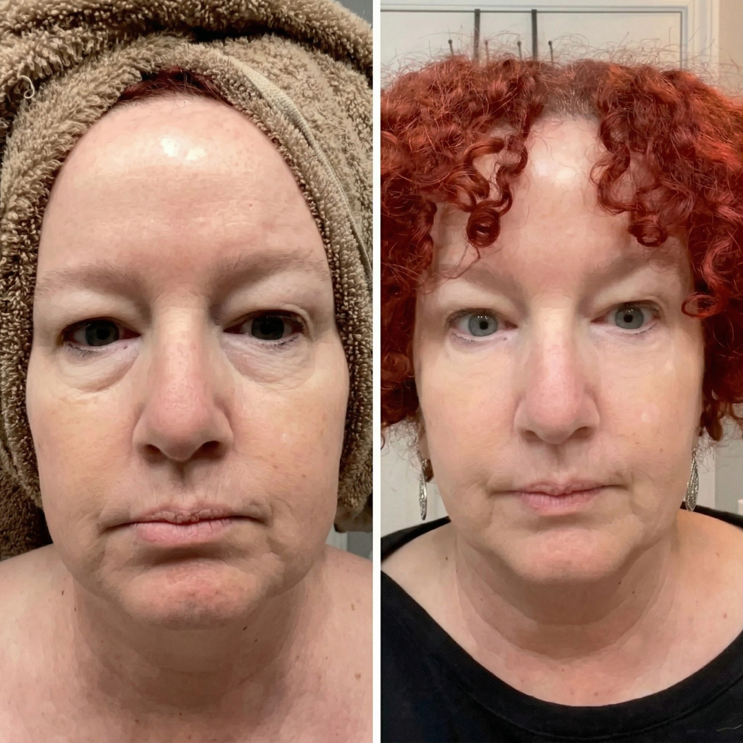 Eye Bag Removing Balm | 1+1 FREE