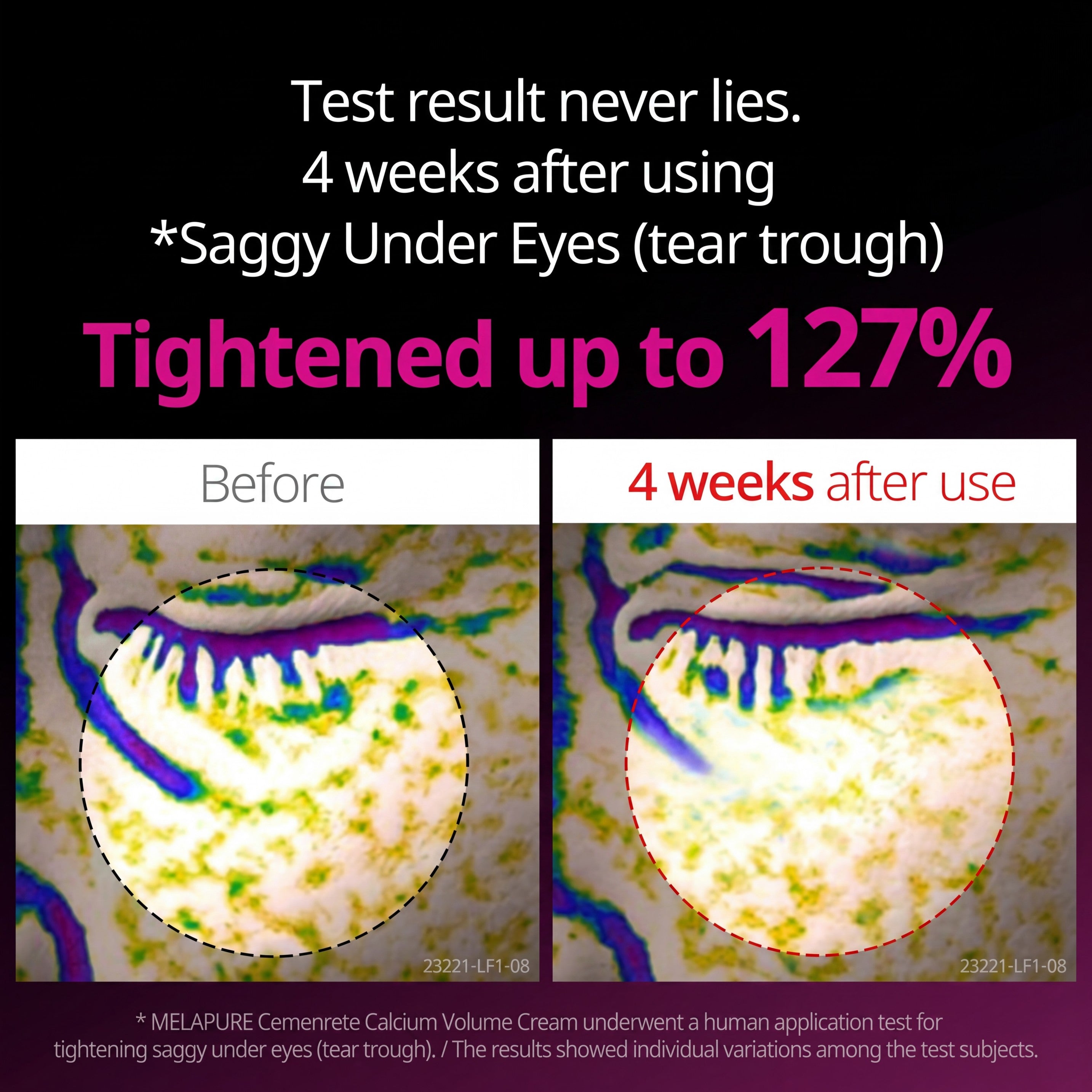 Cemenrete Collagen Calcium Eye Care Line