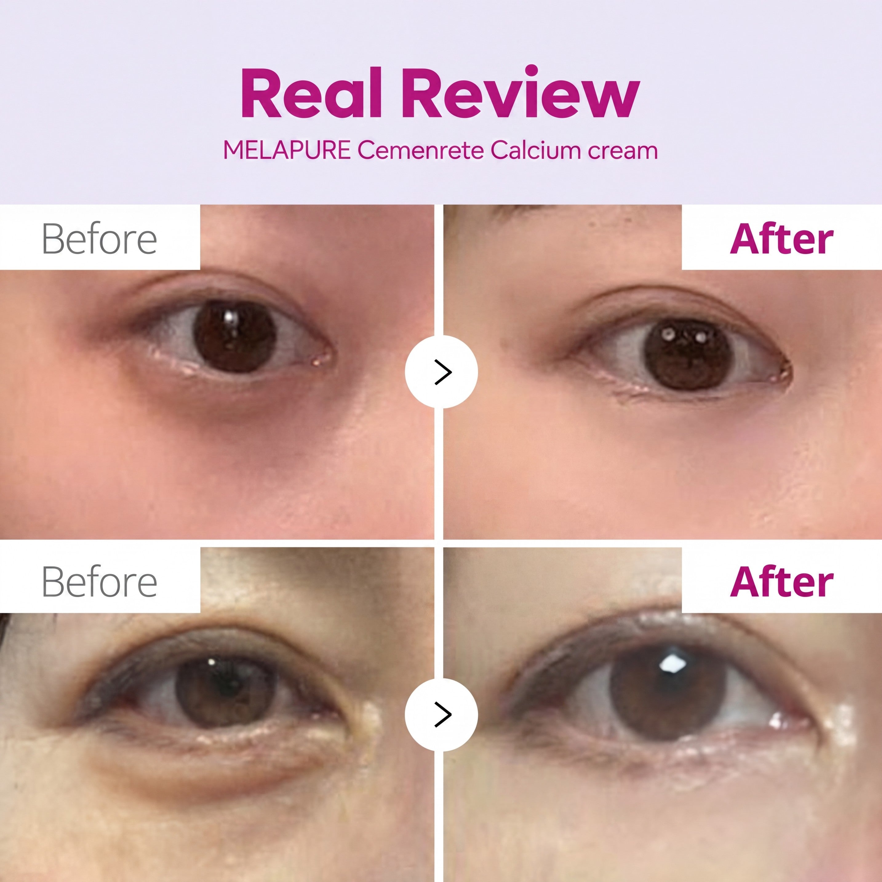 Cemenrete Collagen Calcium Eye Care Line