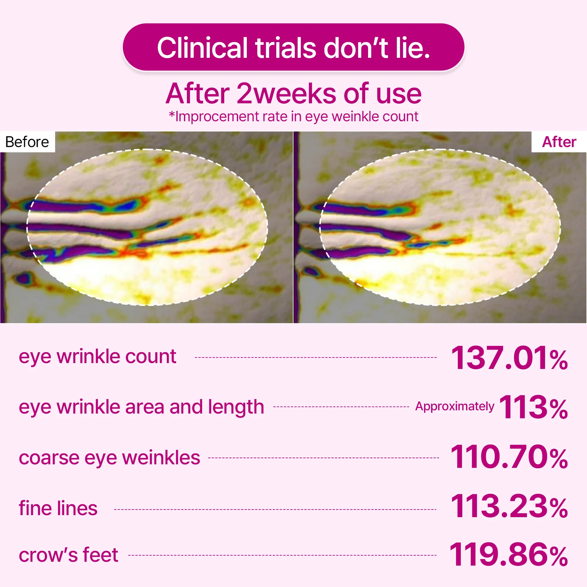 Under-Eye Lift Patches for Dark Circles & Puffiness