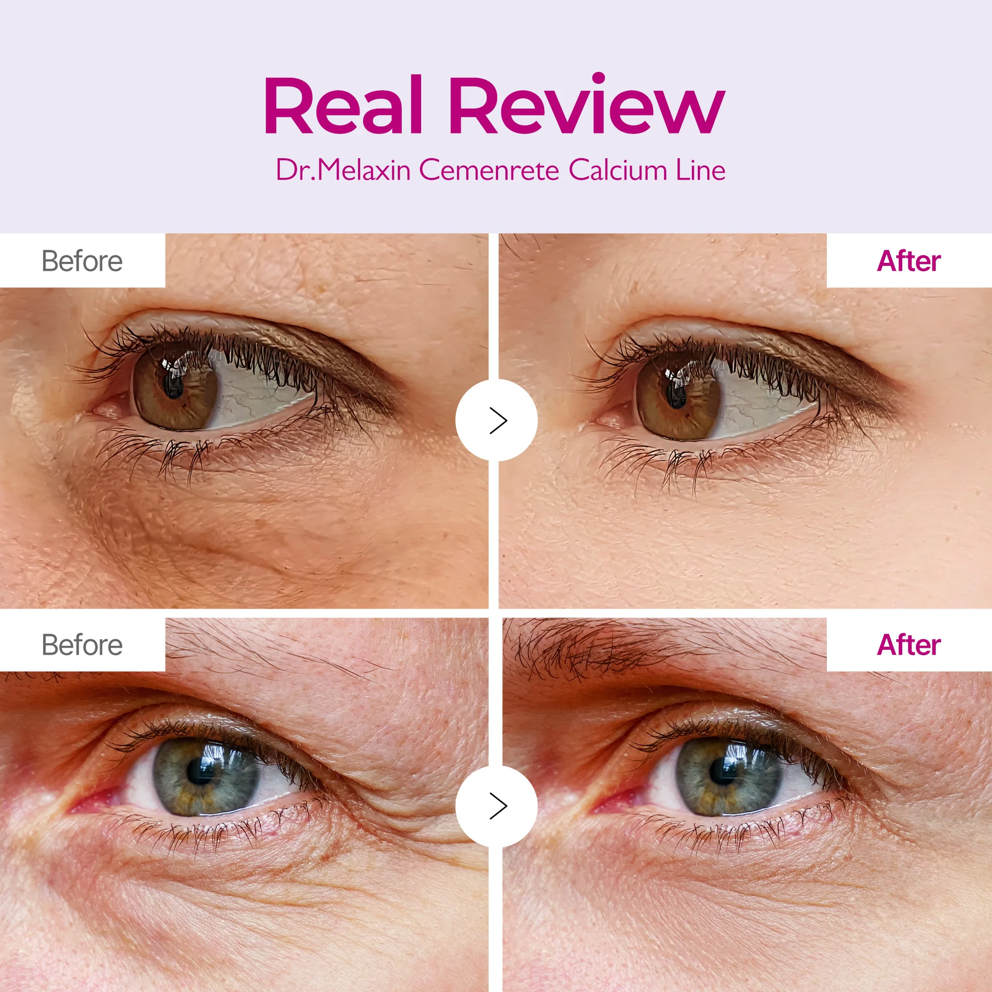 Under-Eye Lift Patches for Dark Circles & Puffiness